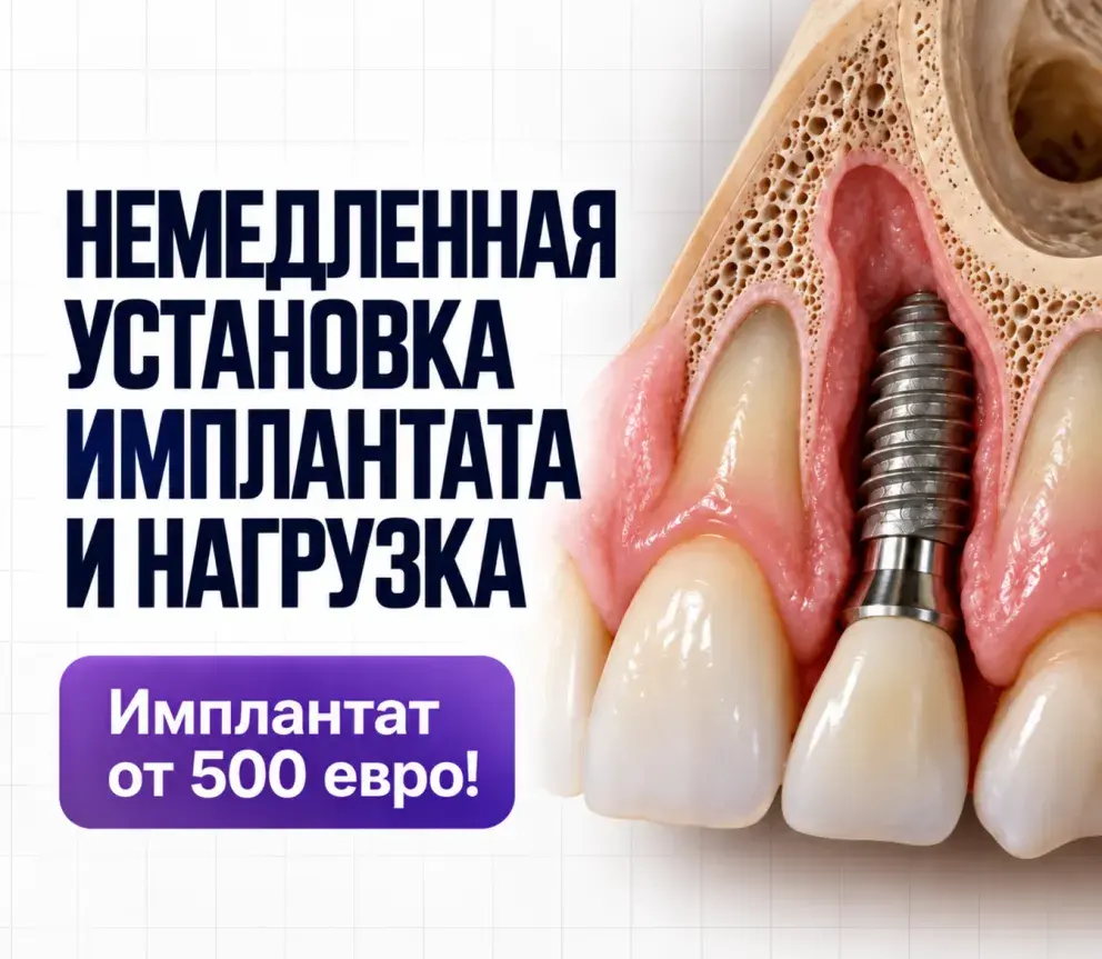 Implantatsia rus 6